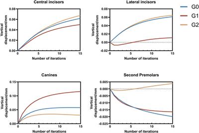 Effects of different intrusion patterns during anterior teeth retraction using clear aligners in extraction cases: an iterative finite element analysis